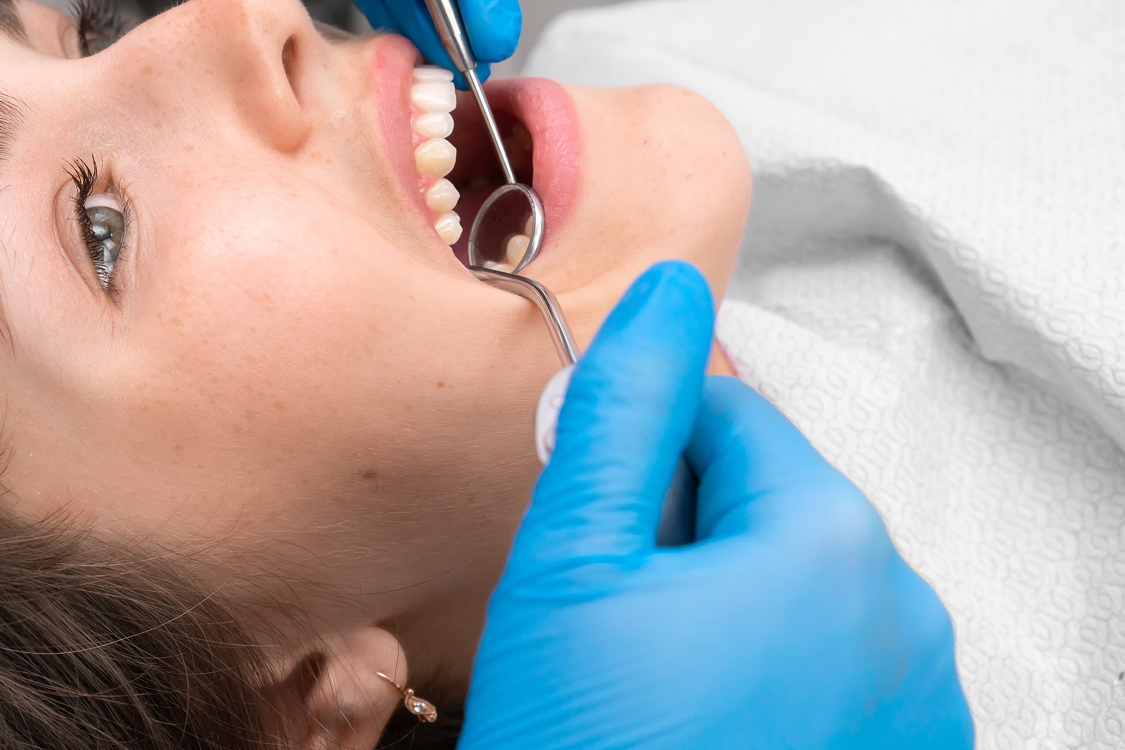 The Dental Exam: What To Expect