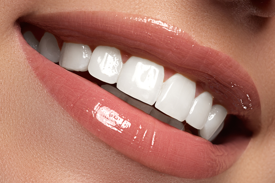 Achieve a Brighter Smile with Professional Teeth Whitening in Peoria, AZ
